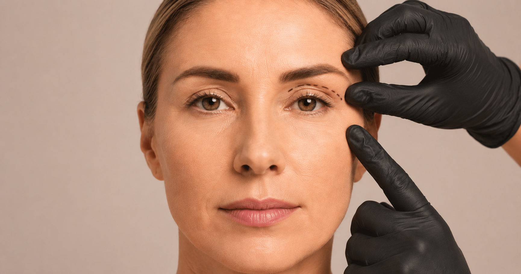 Blefaroplastia superior
